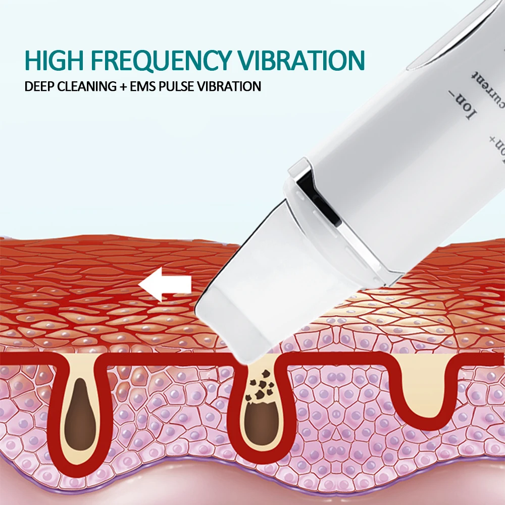 Strokovno Ultrazvočno Obrazno Kožo Scruber Ion Globoko Čiščenje Obraza Piling Za Ponovno Polnjenje Za Nego Kože Naprava Instrument Lepoto